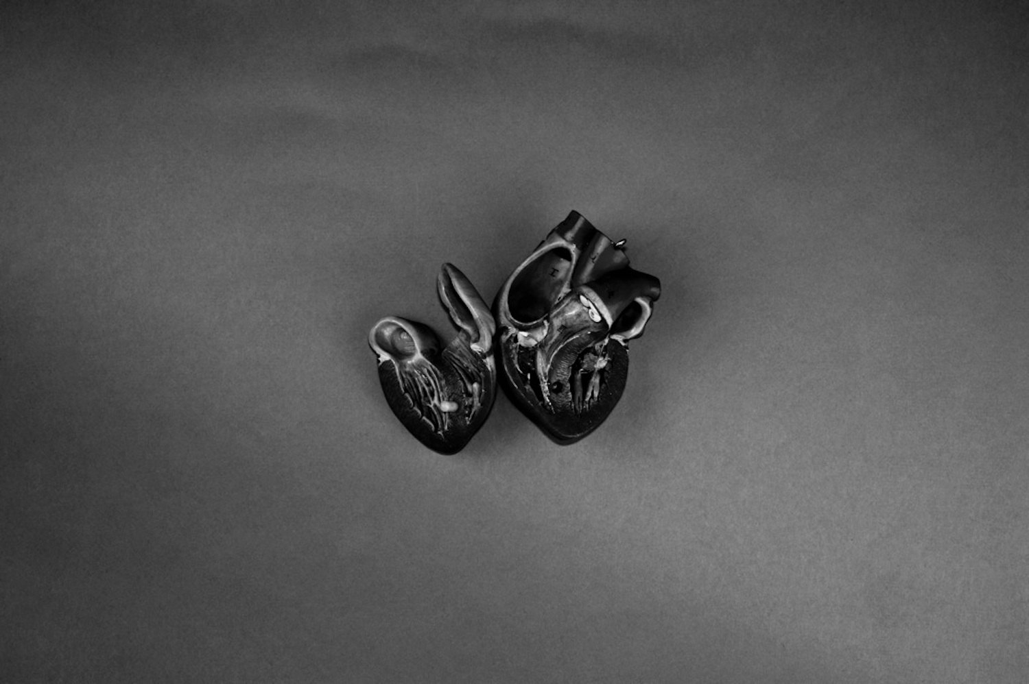 'Heart (Opened)' © Steven Kenny